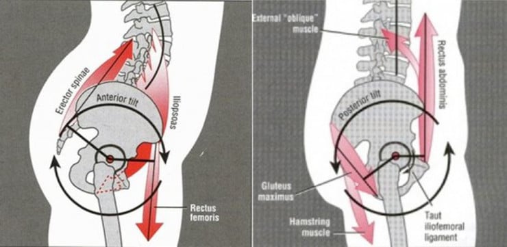 3 Causes of Hamstring Tightness