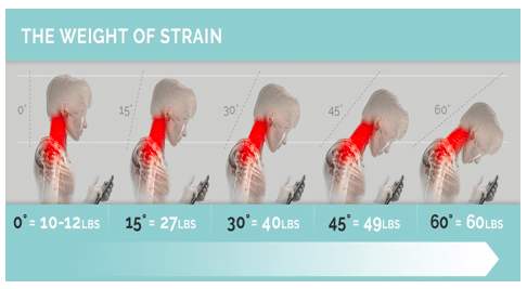 neck pain