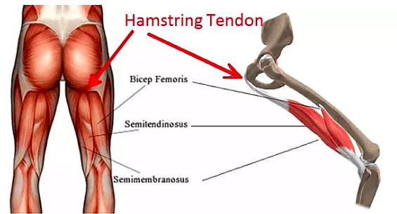 hamstring pain