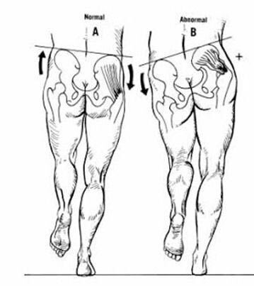 running assessment