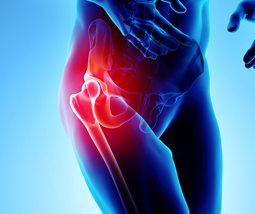 Physical therapy for hip pain symmetry pt miami