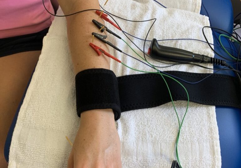 Dry Needling Brickell